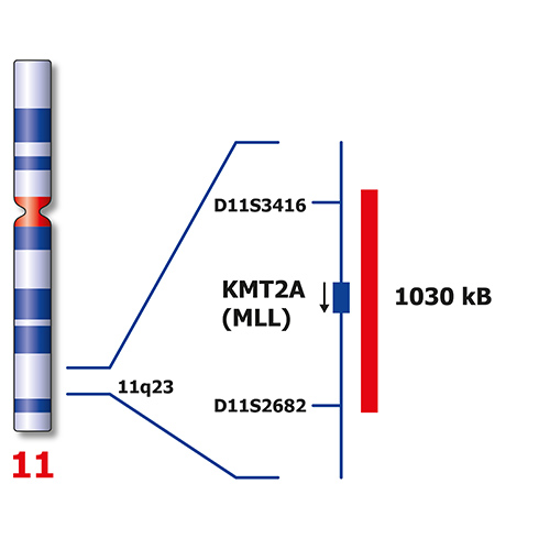 IVD KMT2A/MLLT3 製品画像 Side View S